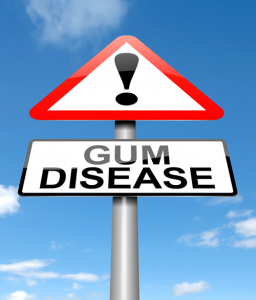 'gum disease sign'