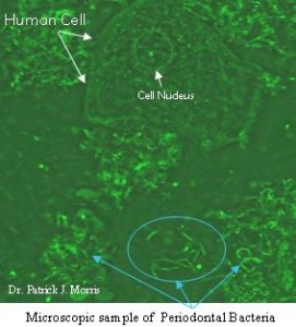 Microscopic sample of periodontal bacteria